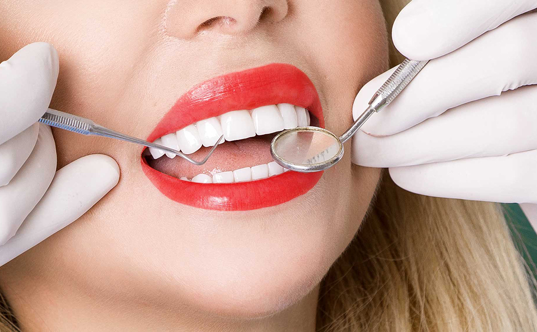 Fillings and Crowns