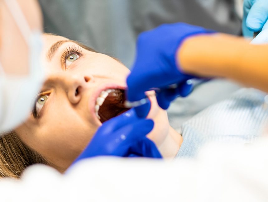 Root Canals