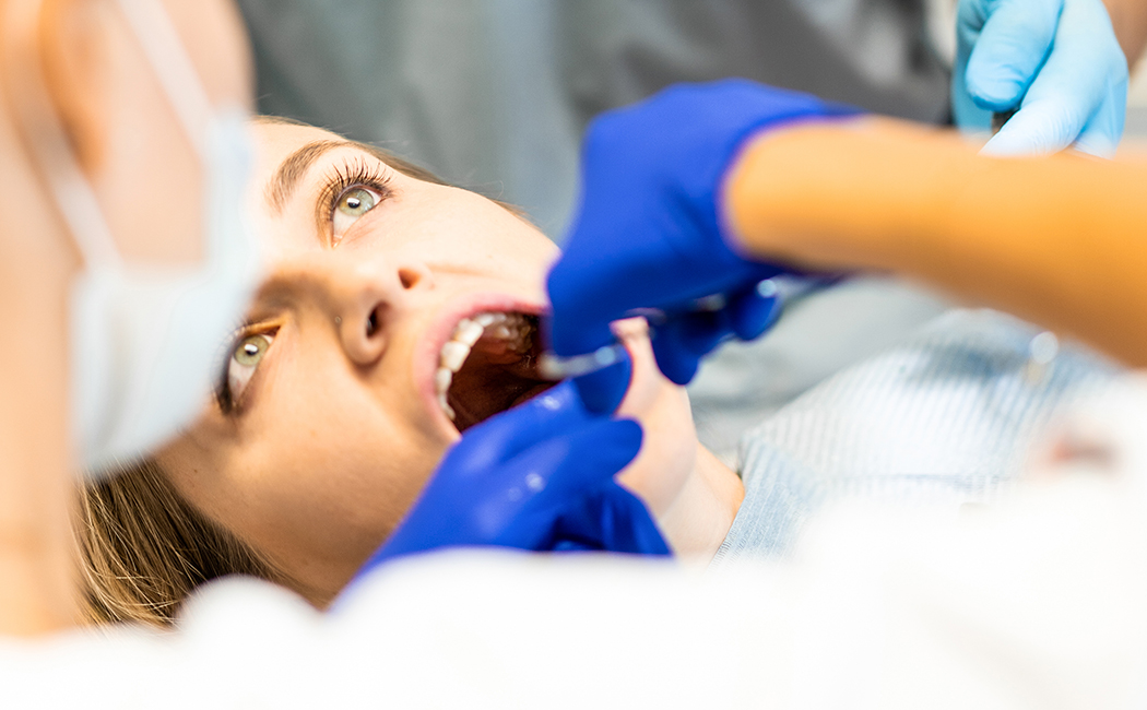 Root Canals